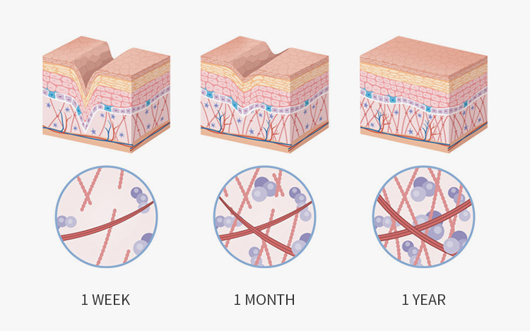 funci&oacute;n-de-LED-Belleza